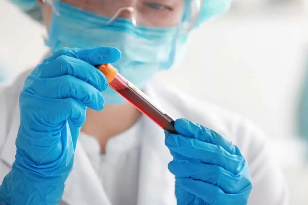 LIMS Software: Vereinfachen Sie die Laborarbeit im Alltag